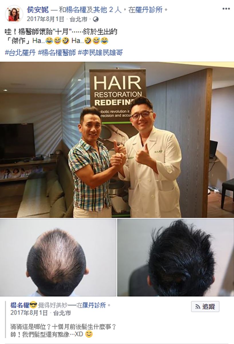 落髮,雄性禿治療,雄性禿,植髮,植髮效果 生髮613